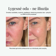 ORRA GLOW 4-in-1