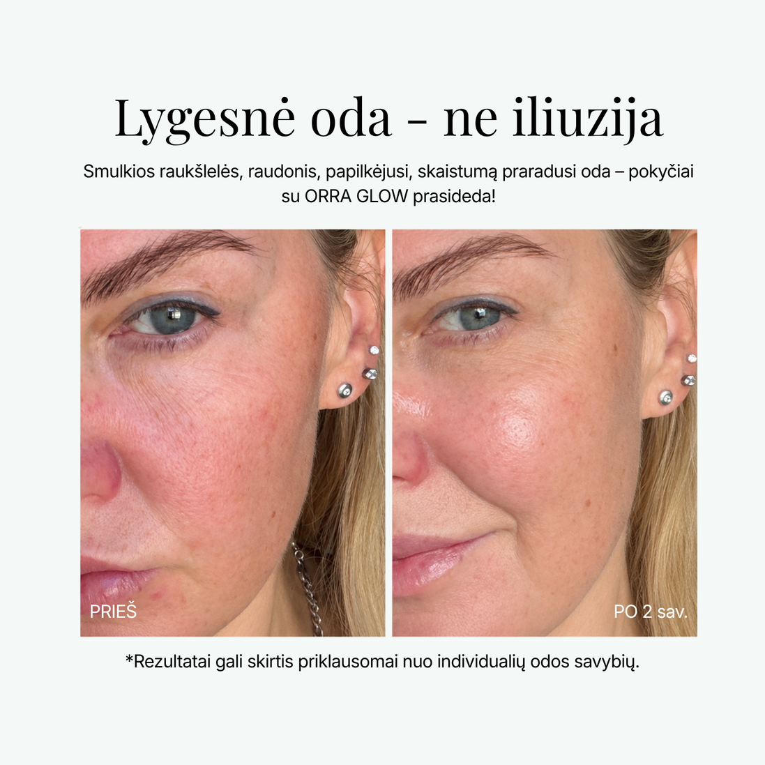 ORRA GLOW 4-in-1